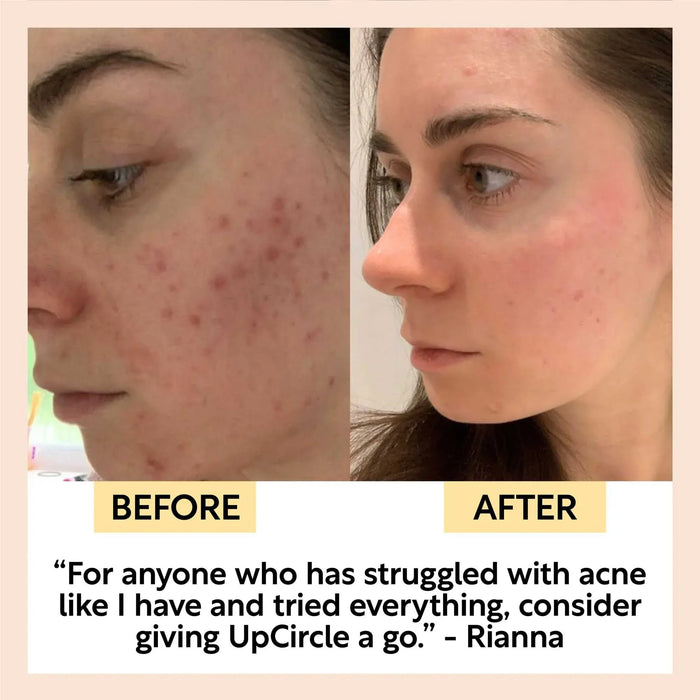 UpCircle Travel-Size Skincare Bundle