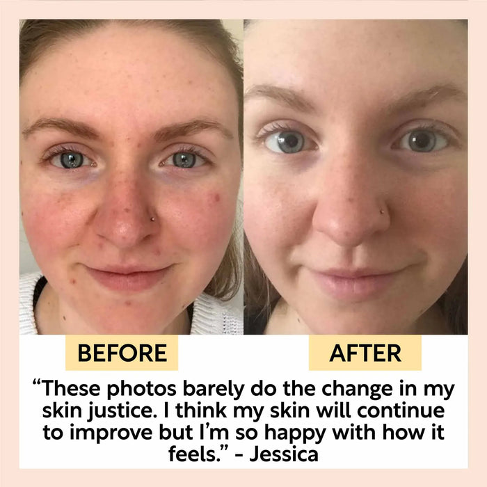 UpCircle Travel-Size Skincare Bundle