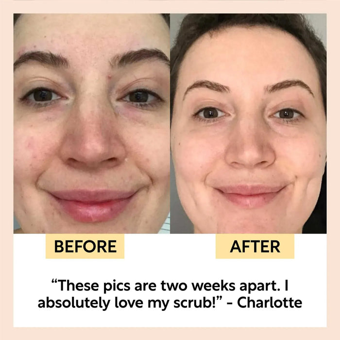 UpCircle Travel-Size Skincare Bundle